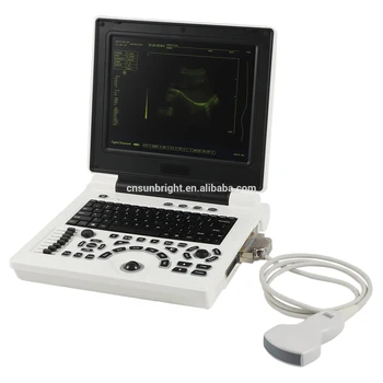 CE Přenosný doppler ultrazvuk ecografo přenosné přístroje, přenosný ultrazvuk s nízkou cenou